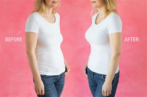 banana shaped boobs|Tubular Breast Before and After Photos